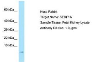 Image no. 1 for anti-Small EDRK-Rich Factor 1A (Telomeric) (SERF1A) (C-Term) antibody (ABIN6750135) (SERF1A 抗体  (C-Term))