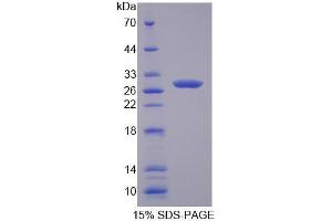 Image no. 1 for Cysteine-Rich Secretory Protein 2 (CRISP2) (AA 22-240) protein (His tag) (ABIN4990393) (CRISP2 Protein (AA 22-240) (His tag))