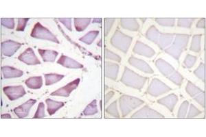 Immunohistochemistry (IHC) image for anti-Ribosomal Protein S6 (RPS6) (AA 191-240) antibody (ABIN1532409)