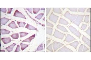 Immunohistochemistry analysis of paraffin-embedded human skeletal muscle tissue, using S6 Ribosomal Protein (Ab-240) Antibody. (RPS6 抗体  (AA 191-240))