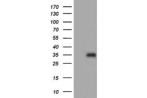 Western Blotting (WB) image for anti-Adiponectin (ADIPOQ) (AA 19-244) antibody (ABIN2715777) (ADIPOQ 抗体  (AA 19-244))