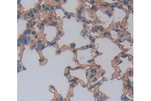 Used in DAB staining on fromalin fixed paraffin- embedded lung tissue (NCR1 抗体  (AA 17-258))