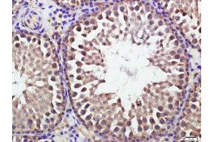 Paraformaldehyde-fixed, paraffin embedded rat testis, Antigen retrieval by boiling in sodium citrate buffer (pH6. (ATG16L1 抗体  (AA 501-607))