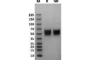 Human Fc gamma RIIIa / CD16a (176F) protein on Coomassie Blue stained SDS-PAGE under non-reducing (NR) and reducing (R) conditions.