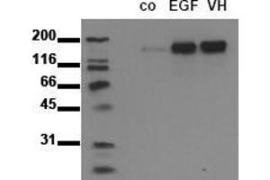 Western Blotting (WB) image for anti-Epidermal Growth Factor Receptor (EGFR) (pTyr1092) antibody (ABIN126770) (EGFR 抗体  (pTyr1092))
