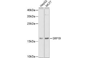 Western blot analysis of extracts of various cell lines, using SRP19 antibody (ABIN6129677, ABIN6148450, ABIN6148451 and ABIN6222484) at 1:1000 dilution. (SRP19 抗体  (AA 1-144))