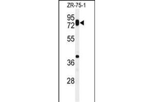 Western blot analysis of HAS1 Antibody (Center) (ABIN651121 and ABIN2840084) in ZR-75-1 cell line lysates (35 μg/lane). (HAS1 抗体  (AA 166-193))