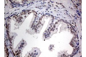 Image no. 6 for anti-TIA1 Cytotoxic Granule-Associated RNA Binding Protein (TIA1) antibody (ABIN1501387)