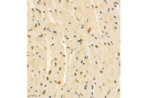 Immunohistochemistry (Paraffin-embedded Sections) (IHC (p)) image for anti-Zinc Finger Protein 106 Homolog (ZFP106) antibody (ABIN7076260)