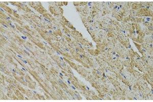 Immunohistochemistry of paraffin-embedded Mouse heart using FHIT Polyclonal Antibody at dilution of 1:100 (40x lens). (FHIT 抗体)