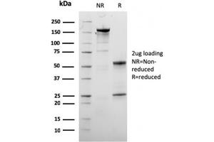 SDS-PAGE Analysis Purified Dystrophin Monospecific Mouse Monoclonal Antibody (DMD/3245). (Dystrophin 抗体  (AA 114-263))