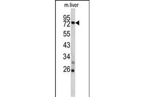 Western blot analysis of TNFAIP2 antibody (Center) (ABIN390522 and ABIN2840874) in mouse liver lysates (35 μg/lane).