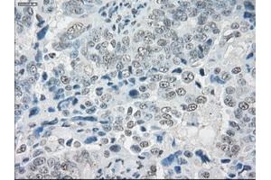 Immunohistochemical staining of paraffin-embedded colon tissue using anti-SLC7A8mouse monoclonal antibody. (SLC7A8 抗体)