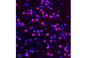 Immunofluorescence of paraffin embedded rat brain using rap1 (ABIN7075857) at dilution of 1: 2000 (400x lens) (RAP1 抗体)