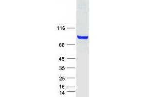 Coagulation Factor XIII, A1 Polypeptide (F13A1) protein (Myc-DYKDDDDK Tag)