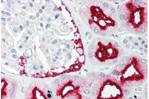 Human Kidney (formalin-fixed, paraffin-embedded) stained with BAG1 antibody ABIN213903 at 5 ug/ml followed by biotinylated goat anti-rabbit IgG secondary antibody ABIN481713, alkaline phosphatase-streptavidin and chromogen.