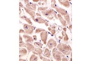 (ABIN651940 and ABIN2840466) staining VLDLR in human heart tissue sections by Immunohistochemistry (IHC-P - paraformaldehyde-fixed, paraffin-embedded sections).