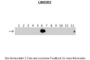 Lanes:   1: 40ng HIS-UBE2D1 protein 2: 40ng HIS-UBE2D2 protein 3: 40ng HIS-UBE2D3 protein 4: 40ng HIS-UBE2D4 protein 5: 40ng HIS-UBE2E1 protein 6: 40ng HIS-UBE2E2 protein 7: 40ng HIS-UBE2E3 protein 8: 40ng HIS-UBE2K protein 9: 40ng HIS-UBE2L3 protein 10: 40ng HIS-UBE2N protein 11: 40ng HIS-UBE2V1 protein 12: 40ng HIS-UBE2V2 protein. (UBE2E2 抗体  (N-Term))