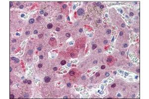 Immunohistochemistry (IHC) image for anti-Glutathione S-Transferase alpha 1 (GSTA1) (AA 1-222) antibody (ABIN782405) (GSTA1 抗体  (AA 1-222))