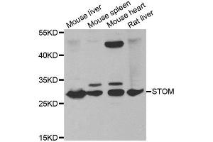 Western blot analysis of extracts of various tissues, using STOM antibody. (Stomatin 抗体)