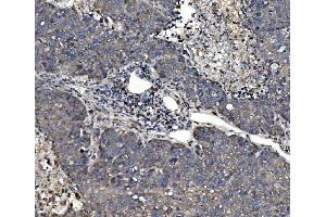 IHC analysis of P4HB using anti-P4HB antibody (ABIN7600075). (P4HB 抗体  (AA 146-363))
