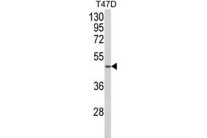 Western Blotting (WB) image for anti-Neutrophil Cytosolic Factor 1C Pseudogene (NCF1C) antibody (ABIN3003869) (NCF1C 抗体)