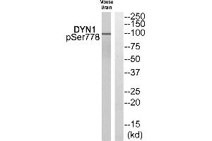 Western blot analysis of extracts from Mouse brain cells, using DYN1 (Phospho-Ser778) antibody. (Dynamin 1 抗体  (pSer778))