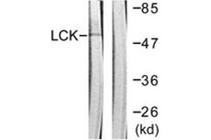 Western blot analysis of extracts from Jurkat cells, using Lck (Ab-192) Antibody. (LCK 抗体  (AA 161-210))