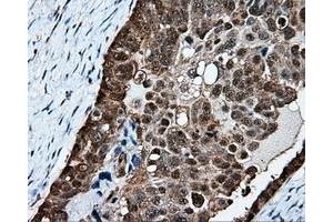 Immunohistochemical staining of paraffin-embedded Kidney tissue using anti-PSMC3 mouse monoclonal antibody. (PSMC3 抗体)