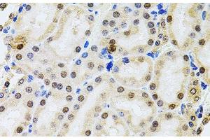 Immunohistochemistry of paraffin-embedded Rat kidney using POP4 Polyclonal Antibody at dilution of 1:100 (40x lens). (RPP29 抗体)