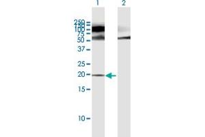 Western Blot analysis of POMP expression in transfected 293T cell line by POMP MaxPab polyclonal antibody. (POMP 抗体  (AA 1-141))