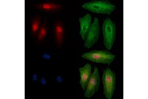 Phospho-PPAR gamma (Ser273) Antibody staining A549 cells(heat shock treatment) by IF/ICC. (PPARG 抗体  (pSer273))