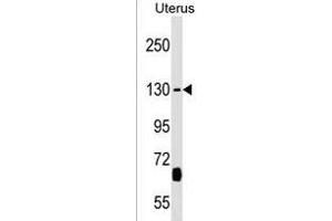 KIF27 Antibody (C-term) (ABIN1536712 and ABIN2838099) western blot analysis in Uterus tissue lysates (35 μg/lane). (KIF27 抗体  (C-Term))