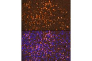 Immunofluorescence analysis of human spleen using Neutrophil Elastase (ELANE) Rabbit mAb (ABIN7266912) at dilution of 1:100 (40x lens). (ELANE 抗体)