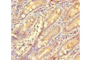 Immunohistochemistry of paraffin-embedded human small intestine tissue using ABIN7154573 at dilution of 1:100 (GCHFR 抗体  (AA 11-55))