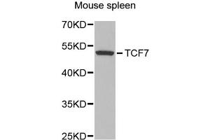 Western blot analysis of extracts of mouse spleen, using TCF7 antibody (ABIN1875040) at 1:300 dilution. (TCF7 抗体)