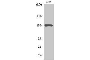 Western Blotting (WB) image for anti-Janus Kinase 1 (JAK1) (Ser639) antibody (ABIN3175726) (JAK1 抗体  (Ser639))