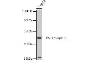 Western blot analysis of extracts of Rat placenta, using PAI-1/Serpin E1 antibody (ABIN6131330, ABIN6147601, ABIN6147603 and ABIN6221802) at 1:1000 dilution. (PAI1 抗体  (AA 24-402))