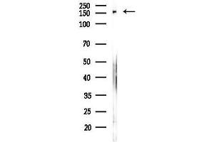 Western blot analysis of lysates from Hela cells(heat-shock,45 min treatment), using ARAP1 Antibody at 1/1000 dilution.