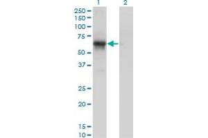 Western Blot analysis of PCTK1 expression in transfected 293T cell line by PCTK1 monoclonal antibody (M01), clone 4D2. (CDK16 抗体  (AA 1-80))