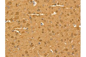 ABIN6264167 and ABIN6269032 at 1/100 staining Rat brain tissue by IHC-P.