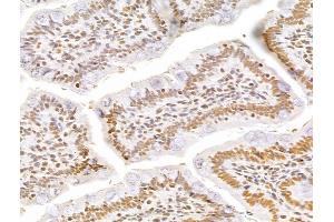 ABIN7094256 and ABIN7098303 at 1/100 staining Rat colon tissue by IHC-P. (GINS3 抗体  (Internal Region))