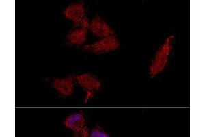 Immunofluorescence (IF) image for anti-Ribosomal Protein L23A (RPL23A) antibody (ABIN7260960)