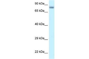 WB Suggested Anti-PPP6R3 Antibody Titration: 1. (PPP6R3 抗体  (C-Term))