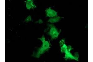 Anti-FBXO21 mouse monoclonal antibody (ABIN2455369) immunofluorescent staining of COS7 cells transiently transfected by pCMV6-ENTRY FBXO21 (RC223095). (FBXO21 抗体)