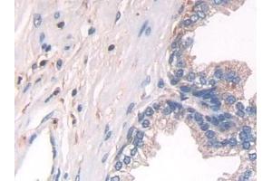 Immunohistochemistry (IHC) image for anti-Interleukin 10 (IL10) (AA 19-178) antibody (ABIN7442330)