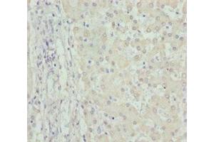Immunohistochemistry of paraffin-embedded human liver tissue using ABIN7149965 at dilution of 1:100 (FMO5 抗体  (AA 1-285))