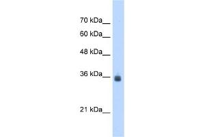 WB Suggested Anti-SDF4 Antibody Titration:  2. (SDF4 抗体  (C-Term))