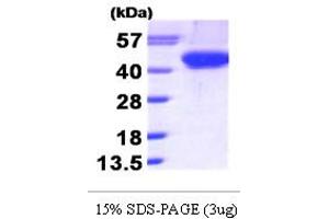 SDS-PAGE (SDS) image for Aurora Kinase B (AURKB) (AA 1-344) protein (His tag) (ABIN668044) (Aurora Kinase B Protein (AURKB) (AA 1-344) (His tag))