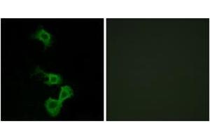 Immunofluorescence analysis of MCF7 cells, using Dab1 (Ab-232) Antibody. (DAB1 抗体  (AA 199-248))